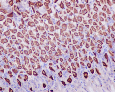 Immunohistochemistry (Formalin/PFA-fixed paraffin-embedded sections) analysis of mouse stomach tissue labelling Prohibitin with ab75766 at 1/250.