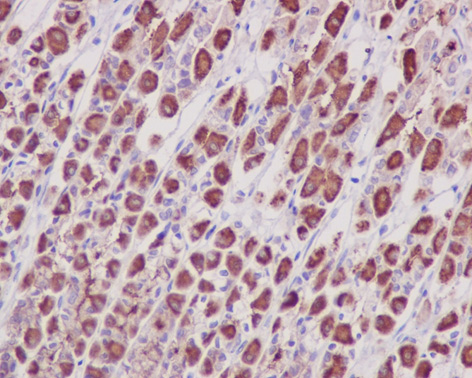 Immunohistochemistry (Formalin/PFA-fixed paraffin-embedded sections) analysis of rat stomach tissue labelling Prohibitin with ab75766 at 1/250.
