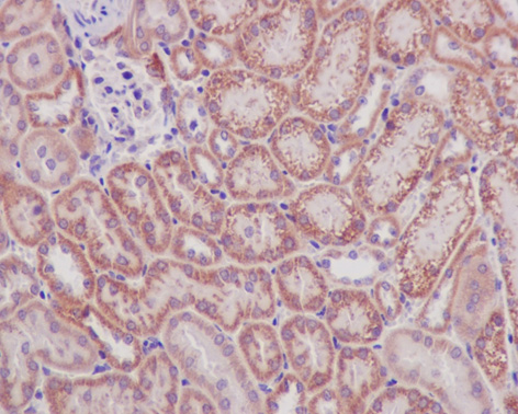 Immunohistochemistry (Formalin/PFA-fixed paraffin-embedded sections) analysis of mouse kidney tissue labelling Prohibitin with ab75771 at 1/250.