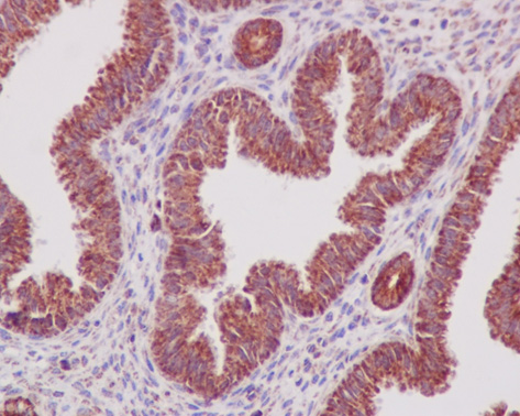 Immunohistochemistry (Formalin/PFA-fixed paraffin-embedded sections) analysis of mouse endometrium tissue labelling Prohibitin with ab75771 at 1/250.