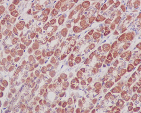 Immunohistochemistry (Formalin/PFA-fixed paraffin-embedded sections) analysis of rat stomach tissue labelling Prohibitin with ab75771 at 1/250.