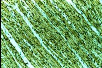 Formalin fixed paraffin embedded human heart stained with Prohibitin antibody ab1836.