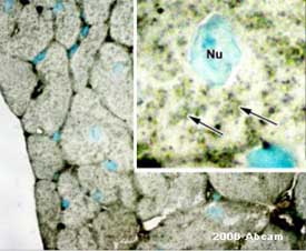 ab1836 at a 1/100 dilution staining mouse Cardiac muscle tissue sections by Immunohistochemistry (Formalin-fixed paraffin-embedded sections). Following heat mediated antigen retrieval the antibody was incubated with the tissue for 12 hours. Bound antibody was detected with a HRP conjuaged anti-mouse antibody. The picture shown is a transverse section of mouse ventricular wall; from TEM studies the distribution of mitochondria among the myofibrils is well-established, and so in this 2-um-thick section there exists both minimal superposition as well as a staining pattern which is consistent with what is expected for cardiac mitochondrial patterns (arrows in the inset indicate groups of prohibitin-positive mitochondria).This image is courtesy of an Abreview submitted by Mike Forbes on 29 March 2006.See Abreview