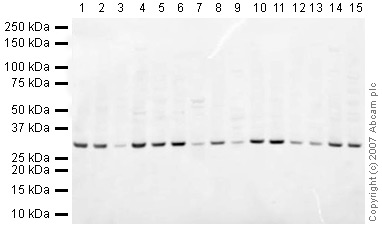 All lanes : Anti-Prohibitin antibody - Mitochondrial Marker (ab28172) at 1 µg/mlLane 1 : NIH 3T3 (Mouse embryonic fibroblast cell line) Whole Cell Lysate (ab7179)Lane 2 : MEF1 (Mouse embryonic fibroblast cell line) Whole Cell LysateLane 3 : Brain (Mouse) Tissue LysateLane 4 : Liver (Mouse) Tissue Lysate - normal tissueLane 5 : Heart (Mouse) Tissue LysateLane 6 : Kidney (Mouse) Tissue LysateLane 7 : Pancreas (Mouse) Tissue Lysate (ab29363)Lane 8 : Testis (Mouse) Tissue Lysate - normal tissueLane 9 : Skeletal Muscle (Mouse) Tissue Lysate (ab29711)Lane 10 : Spinal Cord (Mouse) Tissue LysateLane 11 : Ovary (Mouse) Tissue Lysate - normal tissueLane 12 : PC12 (Rat adrenal pheochromocytoma cell line) Whole Cell LysateLane 13 : Brain (Rat) Tissue Lysate - normal tissueLane 14 : Liver (Rat) Tissue LysateLane 15 : Heart (Rat) Tissue LysateLysates/proteins at 10 µg per lane.SecondaryIRDye 680 Conjugated Goat Anti-Rabbit IgG (H+L) at 1/10000 dilutionPerformed under reducing conditions.