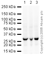All lanes : Anti-Prohibitin antibody - Mitochondrial Marker (ab28172) at 1 µg/mlLane 1 : HeLa (Human epithelial carcinoma cell line) Whole Cell Lysate Lane 2 : Jurkat (Human T cell lymphoblast-like cell line) Whole Cell Lysate (ab7899)Lane 3 : A431 (Human epithelial carcinoma cell line) Whole Cell Lysate (ab7909)Lysates/proteins at 20 µg per lane.SecondaryGoat polyclonal to Rabbit IgG - H&L - Pre-Adsorbed (HRP) at 1/10000 dilutionPerformed under reducing conditions.