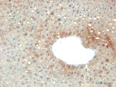ab28172 staining Prohibitin in mouse liver tissue section by Immunohistochemistry (Formalin/PFA-fixed paraffin-embedded sections). Tissue underwent fixation in formaldehyde, heat mediated antigen retrieval in Citrate buffer pH 6.0 and blocking in 1.5% serum for 10 minutes. The primary antibody was diluted, 1/400 and incubated with sample for 1 hour. A HRP conjugated goat polyclonal to rabbit IgG was used undiluted as secondary.See Abreview