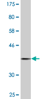 Anti-Prolactin Receptor antibody (ab89215) at 5 µg/ml + Partial tagged recombinant Human Prolactin Receptor protein at 0.2 µg