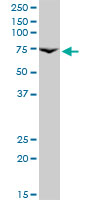 Anti-Prolactin Receptor antibody (ab89215) at 5 µg/ml + A-431 cell lysate at 50 µg