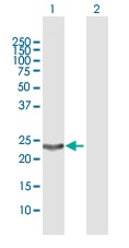 All lanes : Anti-Prostaglandin D Synthase (hematopoietic) antibody (ab169016) at 1 µg/mlLane 1 : Prostaglandin D Synthase (hematopoietic) transfected 293T cell line lysateLane 2 : Non-transfected 293T cell line lysateLysates/proteins at 15 µl per lane.