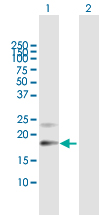 All lanes : Anti-Prostaglandin D Synthase (Lipocalin) antibody (ab167498) at 1 µg/mlLane 1 : Prostaglandin D Synthase (Lipocalin) transfected 293T cell lysateLane 2 : Non-transfected transfected 293T cell lysateLysates/proteins at 15 µl per lane.SecondaryGoat anti-Mouse IgG HRP at 1/2500 dilutiondeveloped using the ECL technique