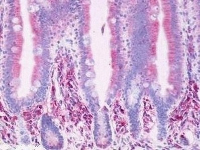 Immunohistochemistry analysis of formalin fixed, paraffin embedded Human small intestine tissue (villi) labelling Prostaglandin D2 Receptor with ab140938 at 6 µg/ml.