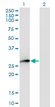 All lanes : Anti-Prostaglandin dehydrogenase 1 antibody (ab118185) at 5 µg/mlLane 1 : HPGD transfected 293T cell line lysateLane 2 : Non transfected 293T cell line lysateLysates/proteins at 25 µg per lane.developed using the ECL technique