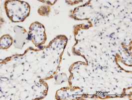 ab118185 at 3 µg/ml staining Prostaglandin dehydrogenase 1 in Formalin-Fixed, Paraffin-Embedded Human Placenta tissue by Immunohistochemistry.