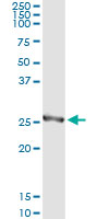 Immunoprecipitation of Prostaglandin dehydrogenase 1 from transfected lysate using ab118185 and Protein A Magnetic beads. Detection by WB utilised an alternative anti-Prostaglandin dehydrogenase 1 rabbit polyclonal antibody.
