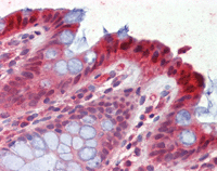 ab115577, at 2.5µg/ml, staining Prostaglandin dehydrogenase 1 in Formalin-fixed, Paraffin-embedded Human Colon tissue by Immunohistochemistry followed by biotinylated secondary antibody, alkaline phosphatase-streptavidin and chromogen.