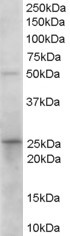 Anti-Prostaglandin dehydrogenase 1 antibody (ab115577) at 0.1 µg + Human duodenum lysate in RIPA buffer at 35 µgdeveloped using the ECL technique