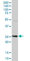 Anti-Prostaglandin dehydrogenase 1 antibody (ab89826) at 1 µg/ml + Human liver tissue lysate at 50 µgdeveloped using the ECL technique