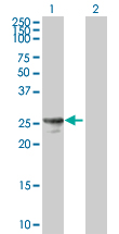 All lanes : Anti-Prostaglandin dehydrogenase 1 antibody (ab89826) at 1 µg/mlLane 1 : cell lysate from Prostaglandin dehydrogenase 1 transfected 293T cellsLane 2 : cell lysate from non transfected 293T cellsLysates/proteins at 25 µg per lane.developed using the ECL technique