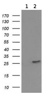 All lanes : Anti-Prostaglandin dehydrogenase 1 antibody [1C12] (ab118005) at 1/2000 dilutionLane 1 : HEK293T lysate transfected with pCMV6-ENTRY control cDNA Lane 2 : HEK293T lysate transfected with pCMV6-ENTRY Prostaglandin dehydrogenase 1 cDNA Lysates/proteins at 5 µg per lane.