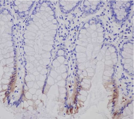 Immunohistochemical analysis of paraffin embedded Human colon tissue labeling Prostaglandin dehydrogenase 1 with ab187160 at 1/4000 with a prediluted HRP Polymer for Rabbit IgG as secondary antibody.