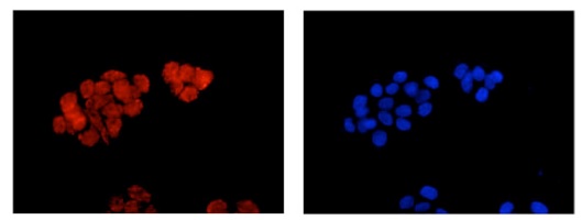 Immunofluorescent analysis of SW480 cells labeling Prostaglandin dehydrogenase 1 with ab187161 at 1/250 and DAPI staining (blue). An anti rabbit IgG (Alexa Fluor®555) was used as the secondary.