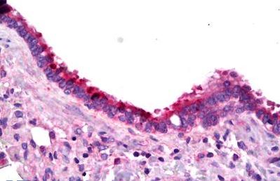 Immunohistochemical analysis of paraffin embedded Human lung tissue labelling Prostaglandin E Receptor EP1 with ab133184 antibody at a concentration of 5 µg/ml, followed by biotinylated secondary antibody, alkaline phosphatase-streptavidin and chromogen.