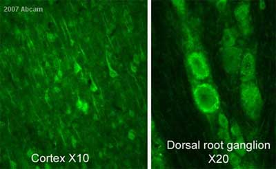 ab6199 staining perfusion fixed rat brain and dorsal root ganglion by IHC-Fr. Animals were pre-perfused with Tris buffer pH 10, followed by 4% paraformadehyde and 15% of a saturated solution of picric acid. The brains were post-fixed in the same fixative overnight, cryoprotected in 20% sucrose for 24 hours, frozen and cut with a cryostat. Free floating immunostaining was performed. An Alexa Fluor ® 488 conjugated goat anti-rat antibody was used as the secondary.The image shows the staining obtained with this antibody using direct fluorescence in the rat cortex and dorsal root ganglion. The staining is not only of the cell body of the cortical neurons but a part of their processes.See Abreview