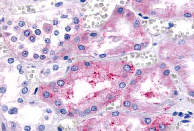 Immunohistochemical analysis of formalin fixed, paraffin embedded Human kidney, renal tubules labeling Prostaglandin E Receptor EP1 with ab140987 at 17 µg/ml.