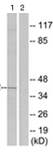 All lanes : Anti-Prostaglandin E Receptor EP2 antibody (ab124419) at 1/500 dilutionLane 1 : Mouse liver cell extractLane 2 : Mouse liver cell extract with synthesized peptide