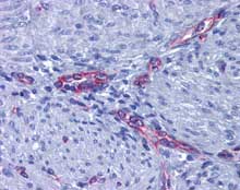 Staining of Prostaglandin E Receptor EP2 in Paraffin-embedded Human Uterus, Myometrium tissue by Immunohistochemistry using ab124419 at a concentration of 5 µg/ml.