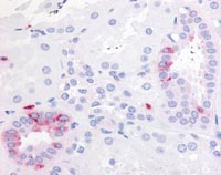 ab117270, at 20-40 µg/ml, staining Prostaglandin E Receptor EP2 in Formalin-fixed, Paraffin-embedded Human Kidney tissue by Immunohistochemistry followed by biotinylated secondary antibody, alkaline phosphatase-streptavidin and chromogen.