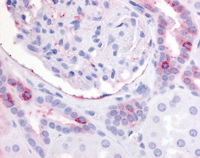 ab115694, at 10µg/ml, staining Prostaglandin E Receptor EP2 in Formalin-fixed, Paraffin-embedded Human kidney tissue by Immunohistochemistry followed by biotinylated secondary antibody, alkaline phosphatase-streptavidin and chromogen.