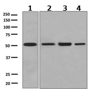All lanes : Anti-Prostaglandin E Receptor EP2 antibody [EPR8030(B)] (ab167171) at 1/1000 dilutionLane 1 : Human placenta lysatesLane 2 : Human fetal lung lysatesLane 3 : JAR cell lysatesLane 4 : WI38 cell lysatesLysates/proteins at 10 µg per lane.SecondaryHRP labeled goat anti-rabbit at 1/2000 dilution