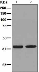 All lanes : Anti-Prostaglandin F2 alpha Receptor antibody [EPR5844] (ab126709) at 1/1000 dilutionLane 1 : MCF7 cell lysateLane 2 : T47D cell lysateLysates/proteins at 10 µg per lane.SecondaryGoat anti-Rabbit HRP at 1/2000 dilution
