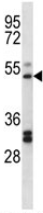 Anti-Prostaglandin I2 Receptor antibody (ab123419) at 1/100 dilution + K562 cell line lysate at 35 µg