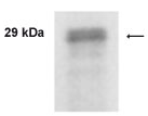 Anti-Prostate Specific Antigen antibody (ab46976) at 1/1000 dilution + LNCaP cells
