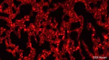 ab15011 at a 1/1000 dilution staining mouse lung tissue sections by Immunohistochemistry (frozen sections). The antibody was incubated with the tissue for 24 hours and then detected using an Alexa Fluor ® 594 comjugated Goat anti-Rabbit IgG antibody. This image is courtesy of an Abreview submitted on 5 January 2006.See Abreview