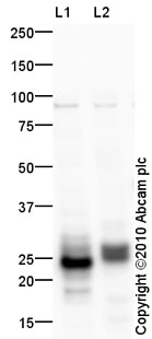 All lanes : Anti-Prosurfactant Protein C antibody (ab90716) at 1 µg/mlLane 1 : Lung (Human) Tissue Lysate Lane 2 : Lung (Mouse) Tissue Lysate Lysates/proteins at 10 µg per lane.SecondaryGoat Anti-Rabbit IgG H&L (HRP) preadsorbed (ab97080) at 1/5000 dilutiondeveloped using the ECL techniquePerformed under reducing conditions.