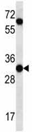 Anti-Protease Inhibitor 15 antibody (ab129259) at 1/100 dilution + K562 cell line lysate at 35 µg