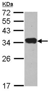 Anti-Protease Inhibitor 15 antibody (ab96835) at 1/1000 dilution + HeLa whole cell lysate at 30 µg