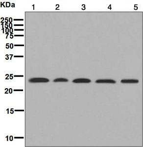 All lanes : Anti-Protease Inhibitor 15 antibody [EPR6328(2)] (ab131209) at 1/1000 dilutionLane 1 : HeLa cell lysateLane 2 : A549 cell lysateLane 3 : HT 1376 cell lysateLane 4 : MDA-MB-43 cell lysateLane 5 : PC3 cell lysateLysates/proteins at 10 µg per lane.SecondaryGoat anti-Rabbit HRP at 1/2000 dilution