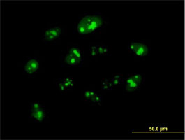 ab70506 at 10µg/ml staining NPM3 in Hela cell by Immunocytochemistry/Immunofluorescence.