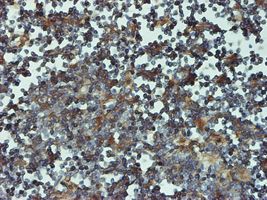 Proteasome 20S beta 6 antibody (ab58079) used in immunohistochemistry at 5ug/ml on formalin fixed and paraffin embedded human lymph node tissue.