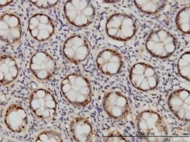 Proteasome 20S beta 6 antibody (ab58081) used in immunohistochemistry at 5ug/ml on formalin fixed and paraffin embedded human colon.
