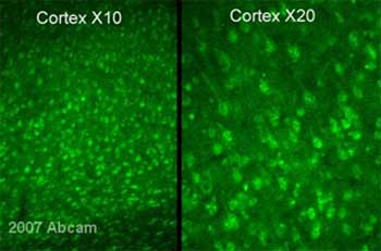 ab6198 at 1/1000 staining perfusion fixed rat brain tissue sections by IHC-Fr. The animals were pre-perfused with Tris buffer pH 10, followed by 4% paraformadehyde and 15% of a saturated solution of picric acid. The brains were post-fixed in the same fixative overnight, cryoprotected in 20% sucrose for 24 hours, frozen and cut with a cryostat. Free floating immunostaining was performed. An Alexa-Fluor ® 488 conjugated goat anti-rabbit antibody was used as the secondary.The image shows the staining obtained with this antibody using direct fluorescence in rat cortical neurons, with two different magnifications of acquisition (X10 and X20).See Abreview