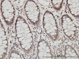 Proteasome 20S LMP7 antibody (ab58094) used in immunohistochemistry at 3ug/ml on formalin fixed and paraffin embedded human colon.