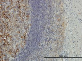 Proteasome 26S S10 antibody (ab58116) used in immunohistochemistry at 3ug/ml on formalin fixed and paraffin embedded human tonsil.