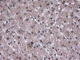 ab118009 at 1/50 dilution, staining Proteasome 26S S10 in Paraffin-embedded Human liver tissue Immunohistochemistry.