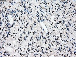 ab118009 at 1/50 dilution, staining Proteasome 26S S10 in Paraffin-embedded Human ovary tissue Immunohistochemistry.