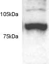 Western blot of proteasome 26S subunit S2 on HeLa cell lysate using ab3315.